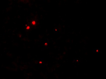 RNASET2 Antibody