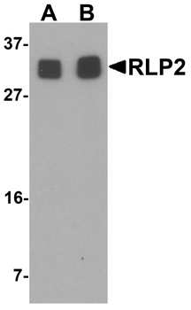 RILPL2 Antibody