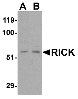 RIPK2 Antibody