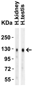 ACE2 Antibody