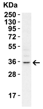 RHBDD1 Antibody