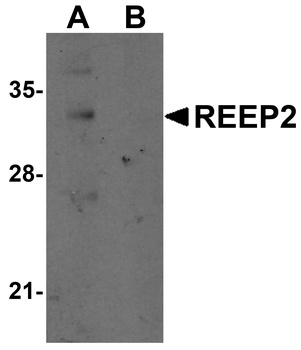 REEP2 Antibody