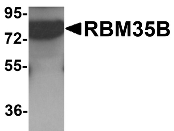 RBM35B Antibody