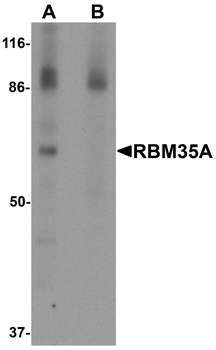 ESRP1 Antibody