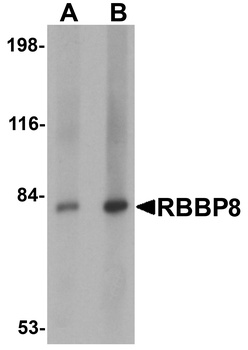 RBBP8 Antibody