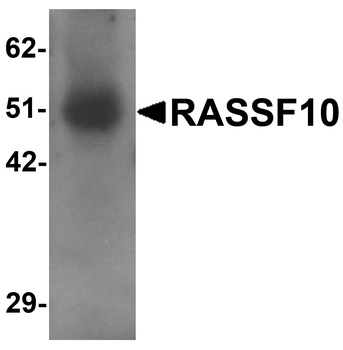 RASSF10 Antibody