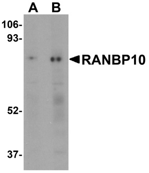 RANBP10 Antibody