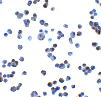 RAET1E Antibody