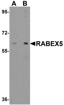 RABEX5 Antibody