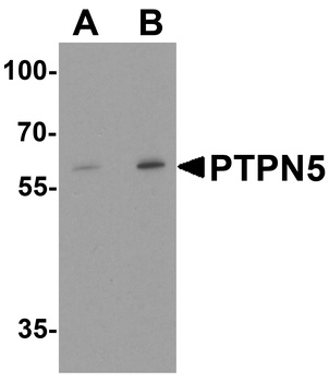PTPN5 Antibody