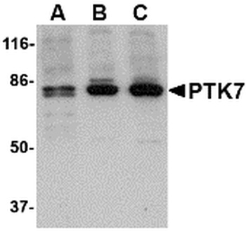 PTK7 Antibody