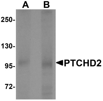 PTCHD2 Antibody
