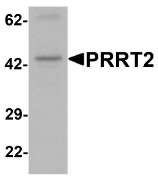 PRRT2 Antibody
