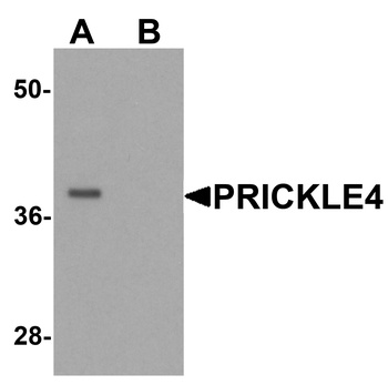 PRICKLE4 Antibody