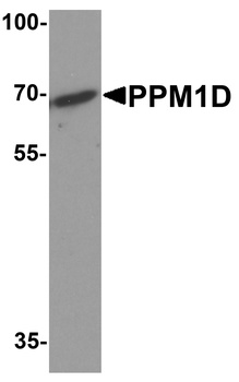 PPM1D Antibody