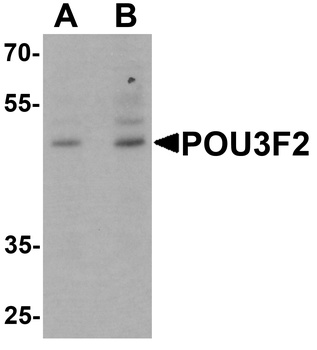 POU3F2 Antibody
