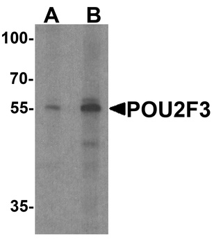 POU2F3 Antibody