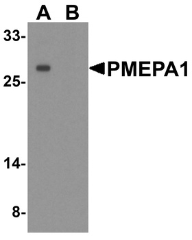 PMEPA1 Antibody