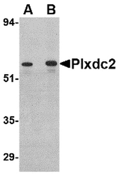 PLXDC2 Antibody