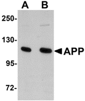 APP Antibody