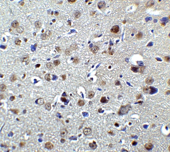 PLAGL2 Antibody