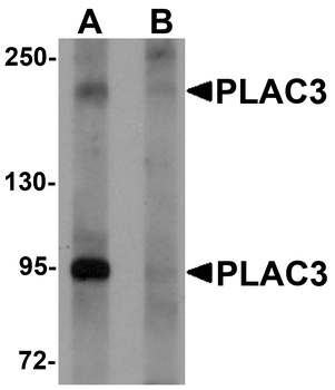 PAPPA2 Antibody