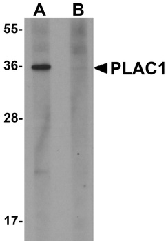 PLAC1 Antibody