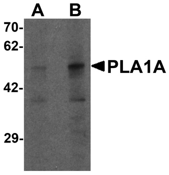 PLA1A Antibody