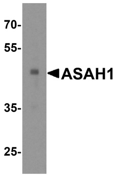 ASAH1 Antibody