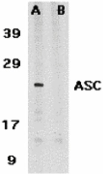 PYCARD Antibody