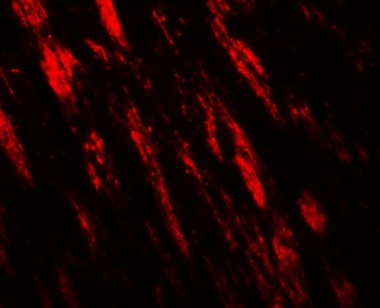 PJA1 Antibody