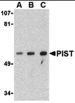 GOPC Antibody