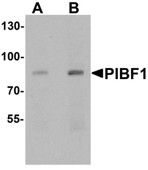 PIBF1 Antibody