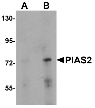 PIAS2 Antibody