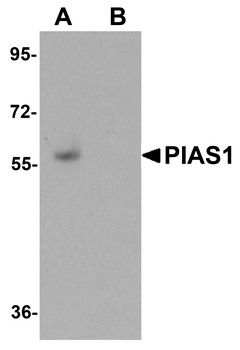 PIAS1 Antibody