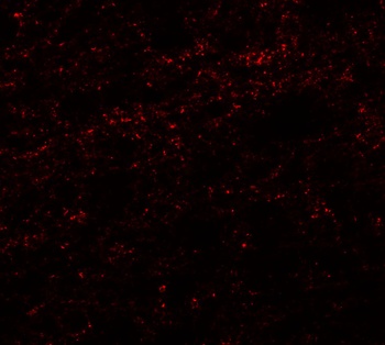 PHOX2A Antibody