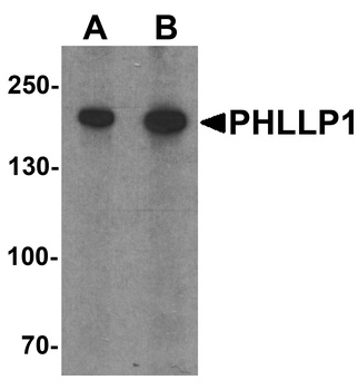 PHLPP1 Antibody