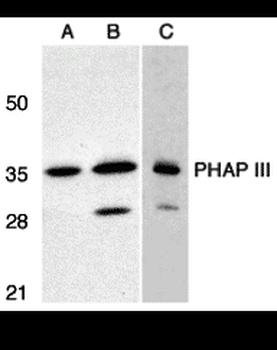 ANP32E Antibody