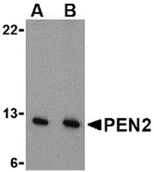 PSENEN Antibody