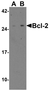 Bcl-2 Antibody