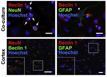 BECN1 Antibody