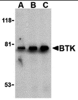 BTK Antibody