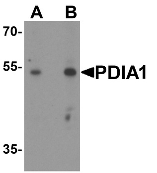 P4HB Antibody