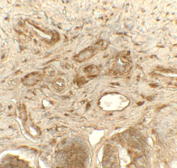 P4HB Antibody