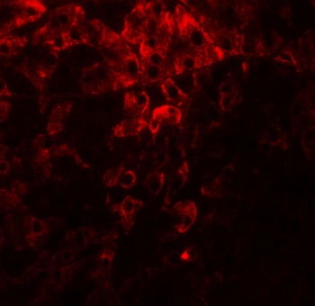 P4HB Antibody