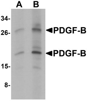 PDGFB Antibody