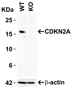 CDKN2A Antibody