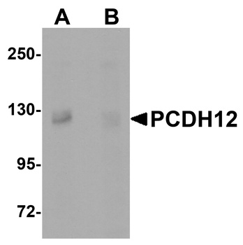 PCDH12 Antibody