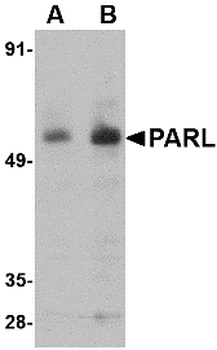 PARL Antibody