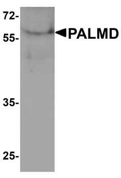 PALMD Antibody
